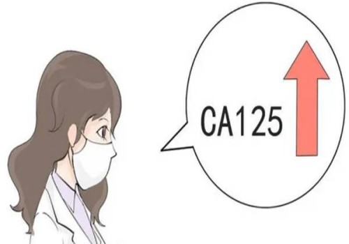 生育保险到底能报销多少钱，一起来看看国家如何规定