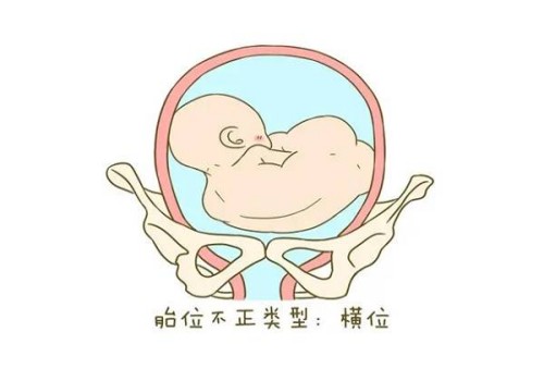深圳助孕供卵代生：﻿子宫出血多囊后是否影响怀孕？做这些能够有效阻止此病症的发生