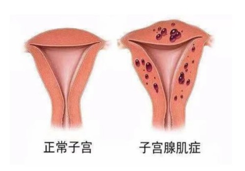 产后出汗都是酸臭味怎么办,产后出汗酸臭是什么原因